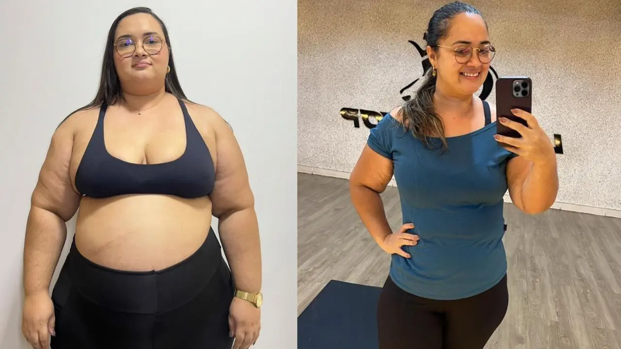 Transformação de paciente - antes e depois