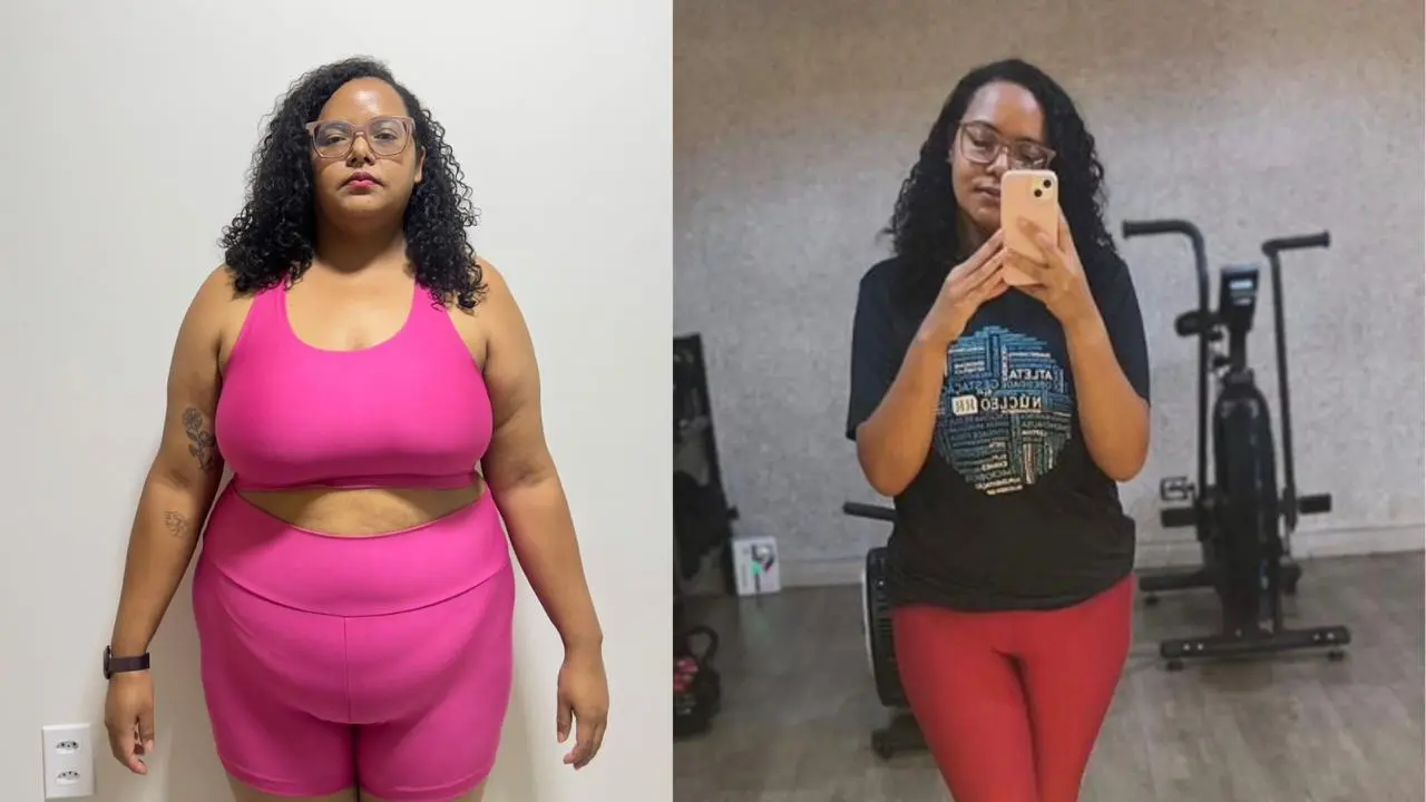 Transformação de paciente - antes e depois